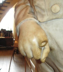 The missing finger